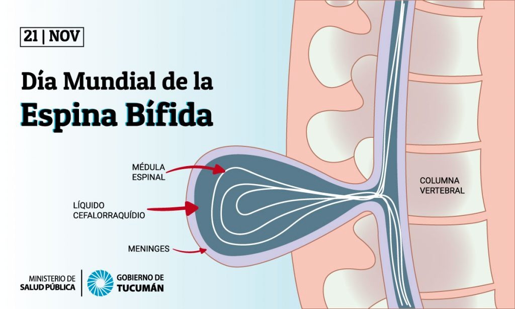 espina bífida oculta rayos x